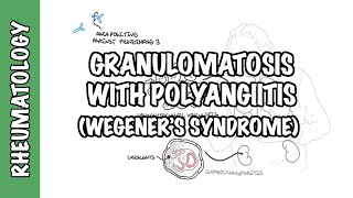 INFLAMMATION Part 9 Chronic Inflammation  GRANULOMATOUS INFLAMMATION [upl. by Bianchi119]