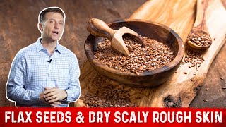 Flaxseed Benefits for Skin amp Symptoms of Linoleic Acid Deficiency – Dr Berg [upl. by Aisan]