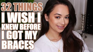 32 THINGS I WISH I KNEW BEFORE GETTING BRACES [upl. by Gilliam370]