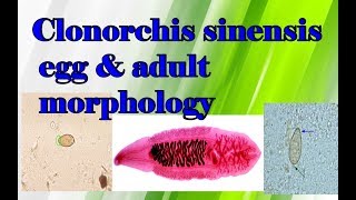 Clonorchis sinensis egg and adult morphology clear explanation [upl. by Onyx]