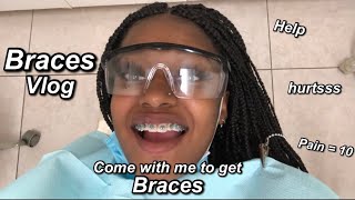 Braces Vlog  Come with me to get braces [upl. by Rehotsirk478]