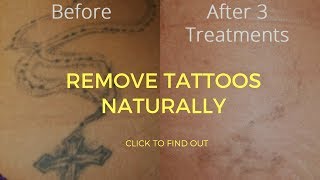 How To Remove Tattoos Naturally [upl. by Dmitri]