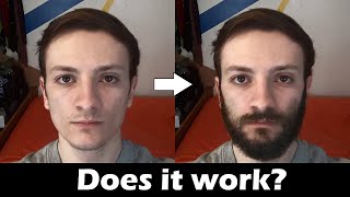 Derma Rolling for Beard Growth Does It Work [upl. by Edan]