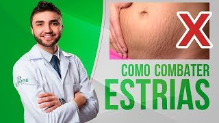 COMO COMBATER AS ESTRIAS  NA BARRIGA SEIOS E BUMBUM  DR LUCAS FUSTINONI  MÉDICO [upl. by Worth]