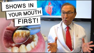 5 Diseases That Show Signs In Your Mouth [upl. by Koeninger]