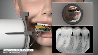 DEXIS™ Titanium by KaVo  Full Mouth Series Positioning Guide [upl. by Chemar]