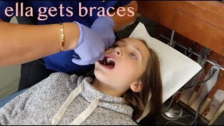 Ella Gets Braces [upl. by Nai]