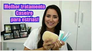 tratamento caseiro para estrias [upl. by Laraine]