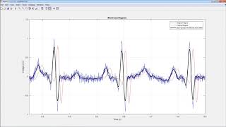 Signal Processing with MATLAB [upl. by Isolt833]